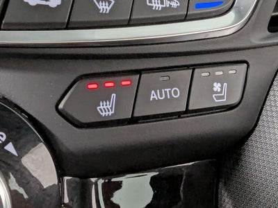 2022 Acura TLX A-Spec Package